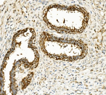 HK1 Antibody / Hexokinase 1