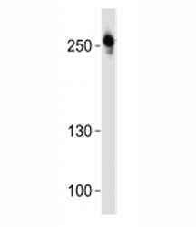 Western blot analysis of lysate from U-87 MG cell line using ROS1 antibody at 1:1000.