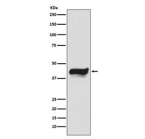 IKB epsilon Antibody / NFKBIE