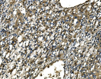CX3CR1 Antibody / CMKBRL1