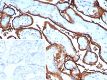 Placental Alkaline Phosphatase Antibody / ALPP