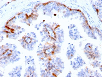 Cystatin A Antibody / CSTA