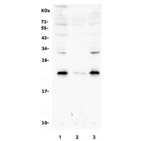 RAB8A Antibody