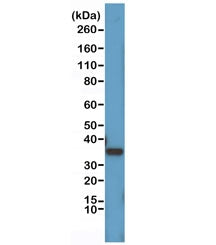 Cyclin D1 Antibody