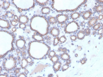 IHC staining of FFPE human thyroid with DBC2 antibody. HIER: boil tissue sections in pH 9 10mM Tris