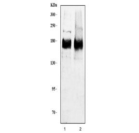 Western blot testing of human 1) HeLa and 2) MCF7 cell lysate with HER2 antibody. Predicted molecula