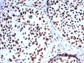HSP70 Antibody / HSPA1B