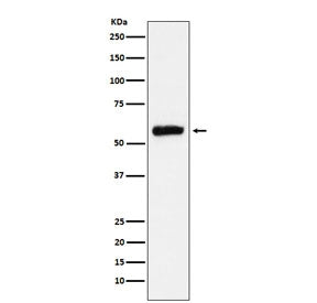 ALDH2 Antibody