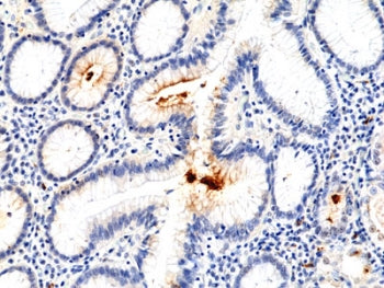 Recombinant Helicobacter pylori Antibody / H. pylori