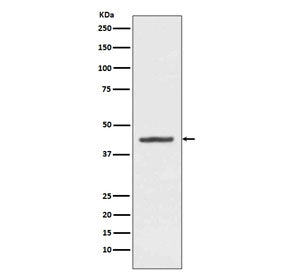 HMBS Antibody