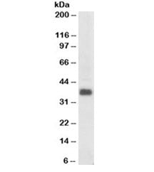 Western blot testing of human colon lysate with Clusterin antibody at 0.3ug/ml. Predicted molecular