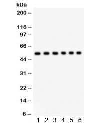 Western blot testing of 1) rat brain, 2) rat testis, 3) mouse brain, and human 4) placenta, 5) 22RV1