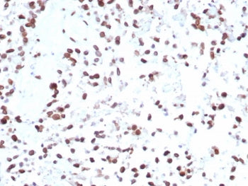 MDM2 Antibody
