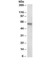 Western blot testing of human hippocampus lysate with GLAST antibody at 2ug/ml. Predicted molecular