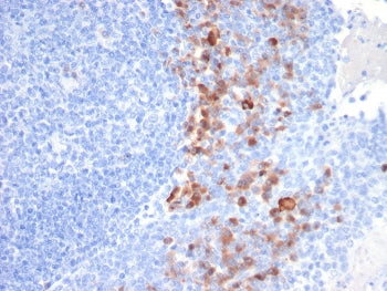 Syndecan-1 Antibody / CD138
