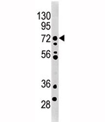 MELK Antibody