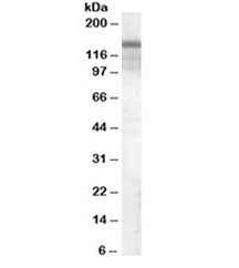 Western blot testing of human brain lysate with TSC1 antibody at 0.1ug/ml. Expected/observed molecul