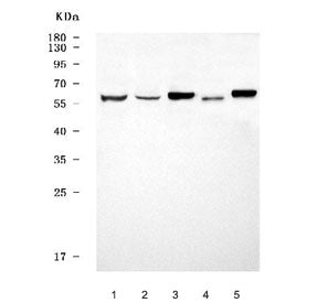 Western blot testing of 1) human SH-SY5Y, 2) human SiHa, 3) rat brain, 4) rat spleen and 5) mouse br