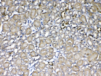 GST pi Antibody / GSTP1