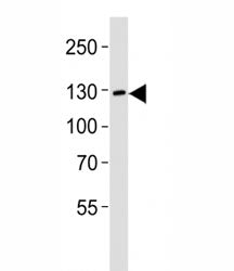 JAK2 Antibody