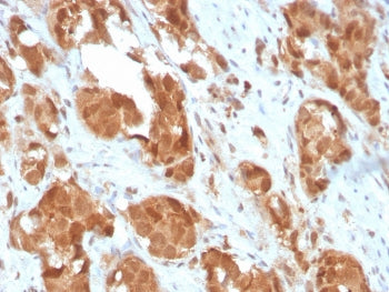 IHC staining of FFPE human prostate with SOD1 antibody. HIER: boil tissue sections in pH 9 10mM Tris