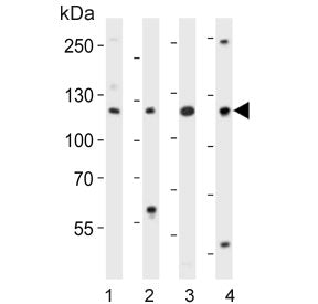 Western blot testing of mouse 1) NIH 3T3, 2) spleen, 3) testis and 4) thymus lysate with Trim 24 ant