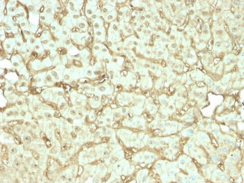 Albumin Antibody / ALB
