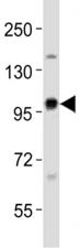 EZH2 Antibody
