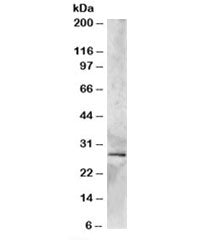 Western blot testing of human heart lysate with SYF2 antibody at 2ug/ml. Predicted molecular weight: