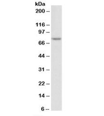Western blot testing of Jurkat nuclear lysate with TDP1 antibody at 2ug/ml. Predicted molecular weig