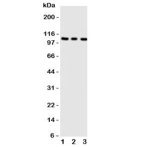 ADAMTS1 Antibody