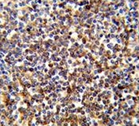 COTL1 Antibody / Coactosin-like protein