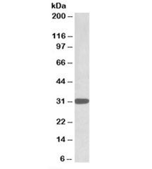 TIPRL Antibody