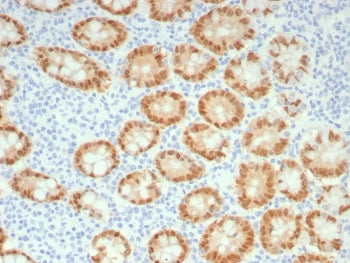 IHC staining of FFPE human colon tissue with recombinant CDX2 antibody (clone rCDX2/9241). HIER: boi