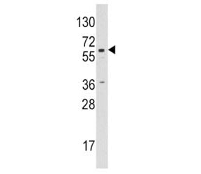 Aromatase Antibody (CYP19A1)