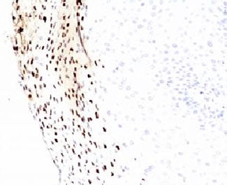 HPV-16 L1 Antibody