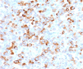 Tyrosinase Antibody