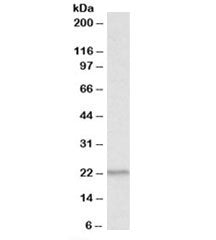 PSMB9 Antibody