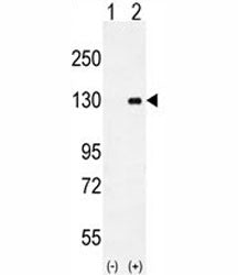 CSF1R Antibody