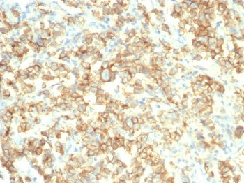 S100A14 Antibody