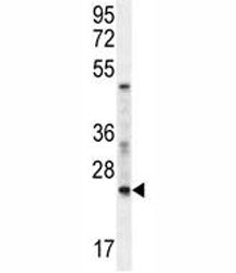 RAN Antibody