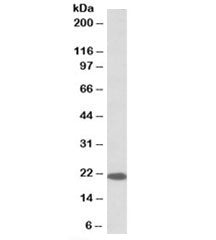 Dnajc5 Antibody
