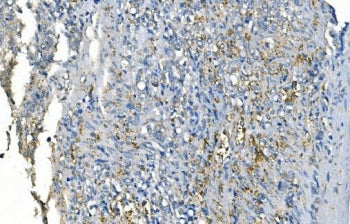 CA1 Antibody / Carbonic Anhydrase I