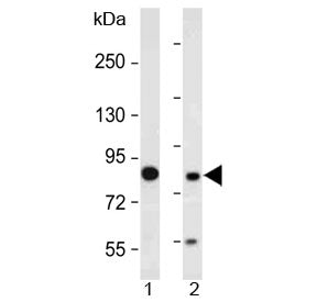 MUT Antibody / Methylmalonyl-CoA mutase (N-Terminal Region)