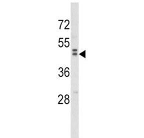 WNT10B Antibody