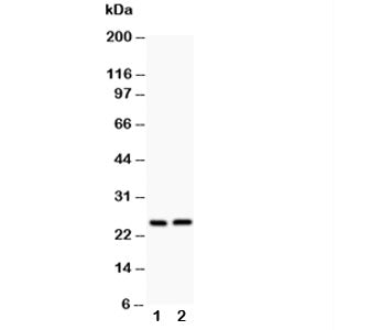 Western blot testing of Claudin 2 antibody and Lane 1: rat kidney; 2: rat liver