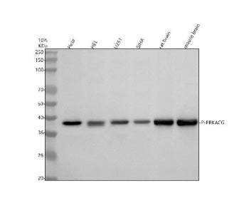 Western blot analysis of P-PRKA/C/G using anti-Phospho-PKA C (Thr197) antibody. Electrophoresis was
