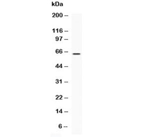 LBP Antibody / Lipopolysaccharide Binding Protein