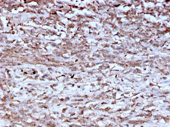 Cathepsin K Antibody / CTSK