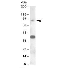 Western blot testing of rat testis lysate with MARCH10 antibody at 0.3ug/ml. Predicted/observed mole